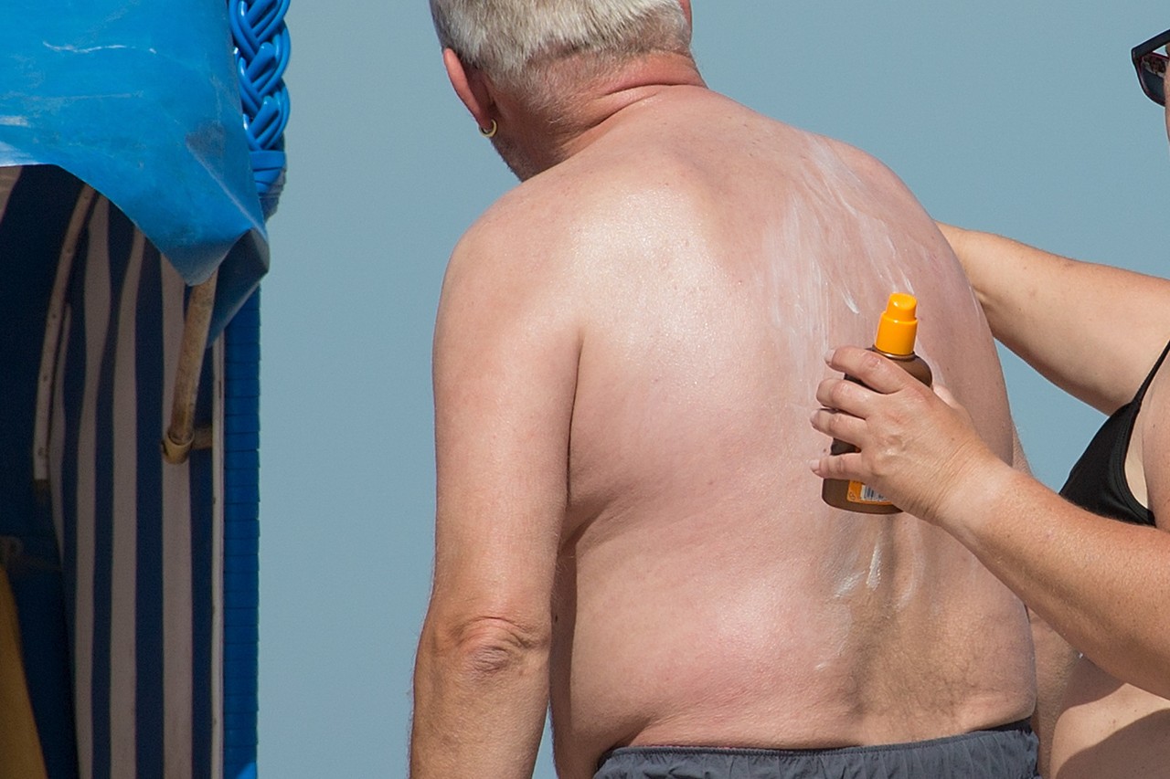 Nordsee und Ostsee: Eine Frau cremt einem Mann den Ruecken mit Sonnenschutz ein. 